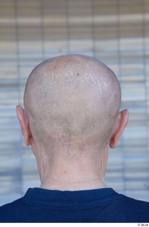 Street  809 bald head 0004.jpg